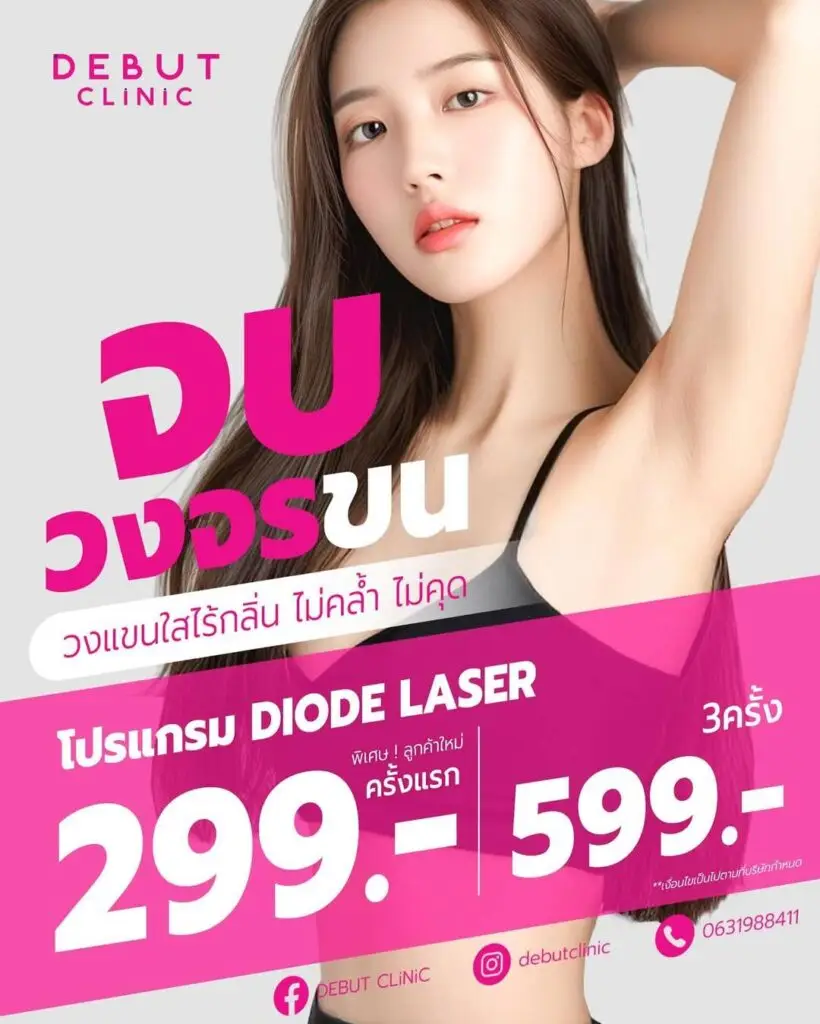 เลเซอร์กำจัดขนรักแร้